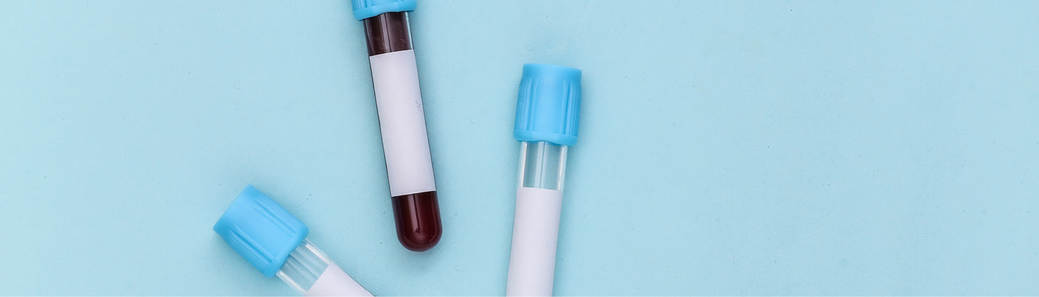 fda одобрило тест‑систему для диагностики болезни альцгеймера по анализу крови fda одобрило тест‑систему для диагностики болезни альцгеймера по анализу крови