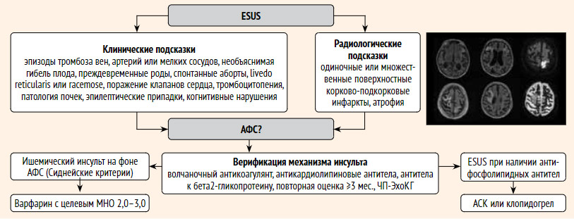 Лечение антифосфолипидного синдрома - Клиника «Антуриум», Барнаул