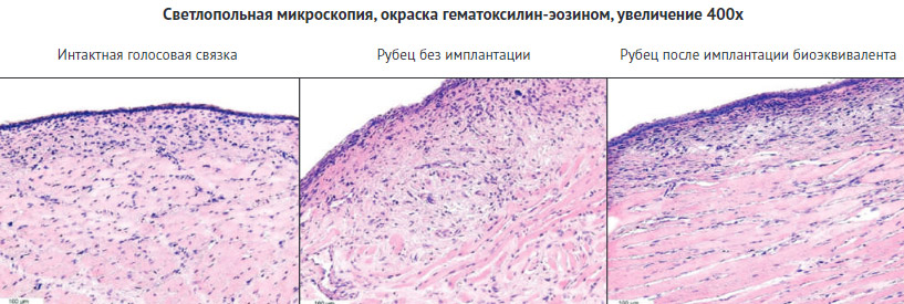 Рисунок 6. Микроскопическая картина интактной и восстановленных голосовых связок