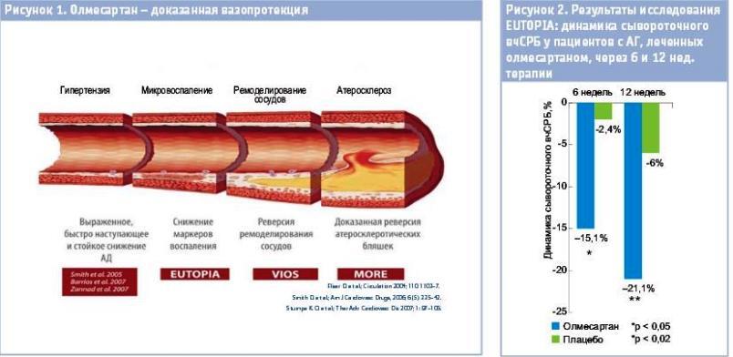 Ремоделирование сосудистой стенки